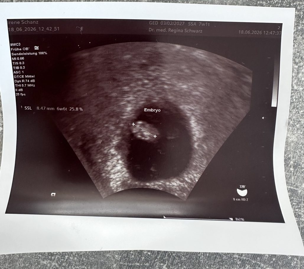 Ultraschall 18.06.2026, SSL-Messung 8,47 mm